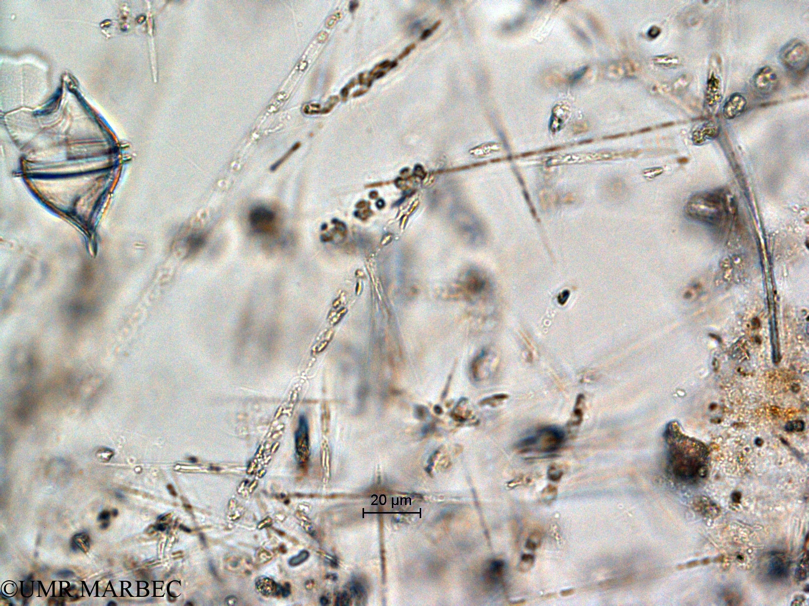 phyto/Scattered_Islands/all/COMMA April 2011/Dactyliosolen sp2 (ancien Dactyliosolen fragilissimus -ancien Guinardia sp4 ou Cerataulina sp)(copy).jpg